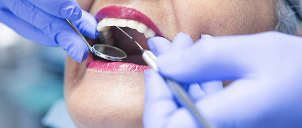 Best Emergency Dental Extractions in West Wood, UT