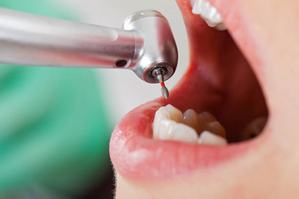 Best Pediatric Emergency Dentist in West Wood, UT